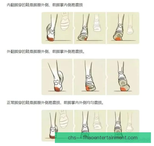 香港马拉松跟骨滑囊炎高发，跑者如何科学防护康复